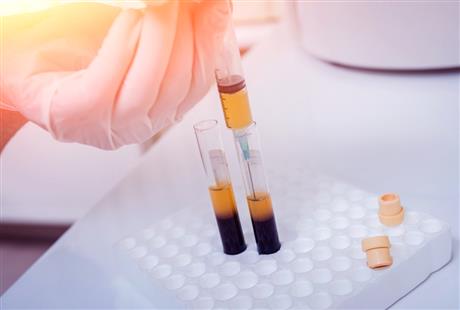 Techmart Công nghệ sinh học 2020: Công nghệ 5PRP kích thích lành hóa và tái tạo các mô tổn thương